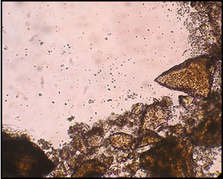 Кристаллы минерального компонента костной ткани -  «Аллогенный гидроксиапатит» серии «Лиопласт»®  рН > 8